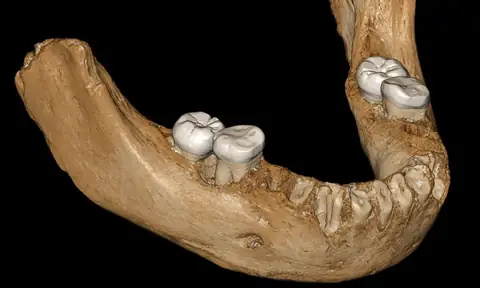 190,000-Year-Old Denisovan Jawbone Found in Taiwan